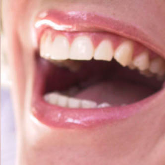 Closeup of open mouth smile